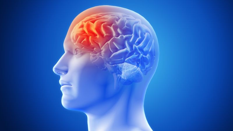Đau đầu là bệnh gì, có liên quan đến u não 