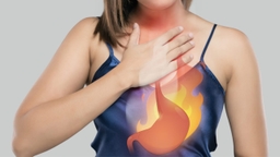 Ợ chua là bệnh gì? Nguyên nhân và cách điều trị hiệu quả