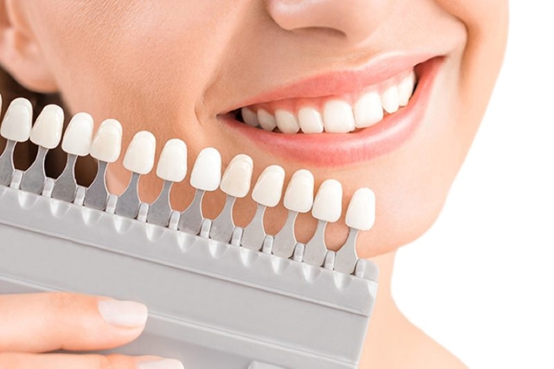 Phương pháp bọc răng sứ Nacera chất lượng