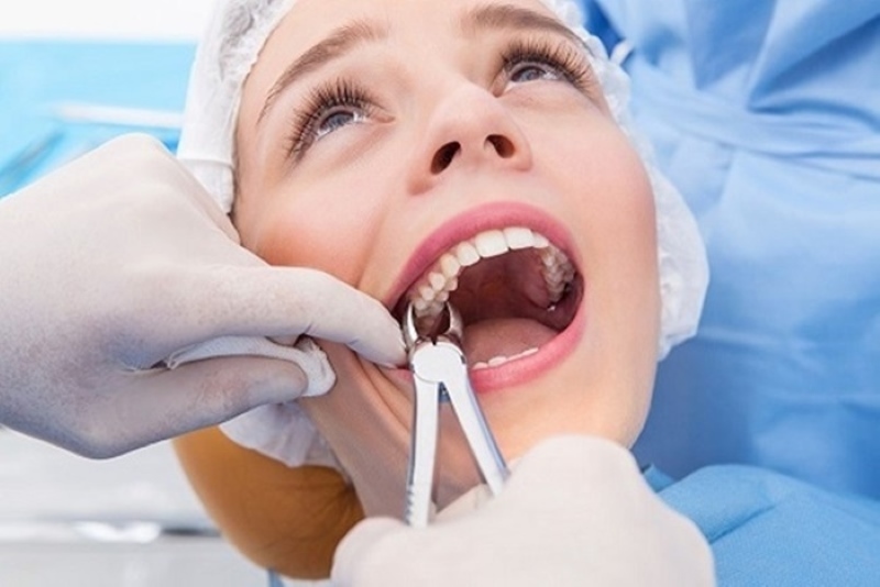 Nhổ răng hàm không đau và cách chuẩn bị tâm lý vững vàng trước khi nhổ răng