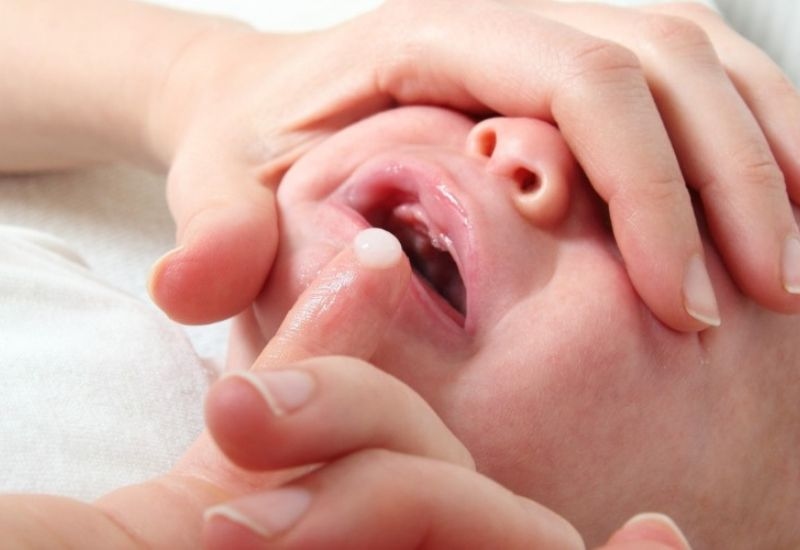 Điều trị khi trẻ bị nấm miệng