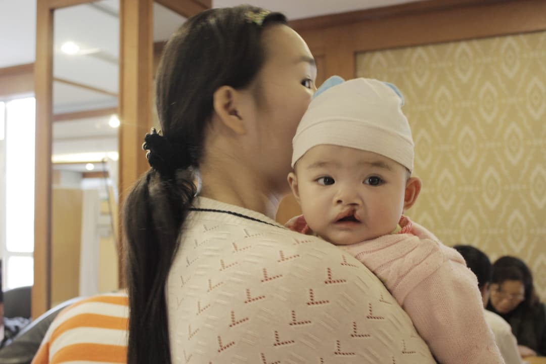 bệnh viện thu cúc phẫu thuật miễn phí cho trẻ em nghèo