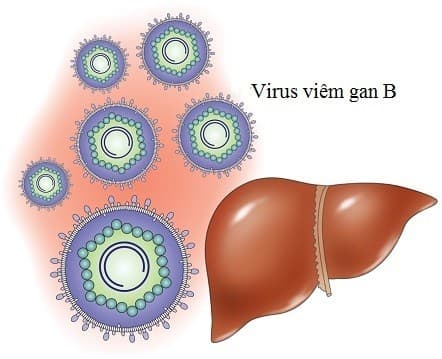 Điều trị bệnh gan siêu vi B phương pháp điều trị