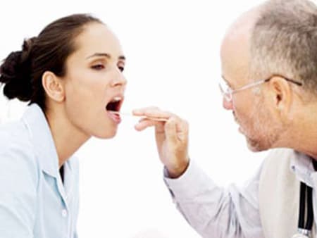 Thuốc trị đau họng