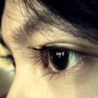 Phụ nữ mang thai có thể bị bong võng mạc sau sinh