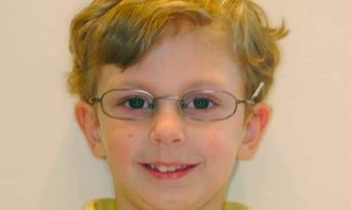 Cận thị mắt là gì? Làm gì để phòng tránh hiệu quả width=