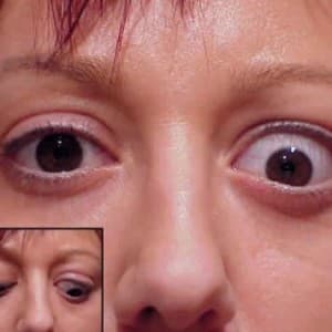 Địa chỉ bệnh viện mắt uy tín tại Hà Nội