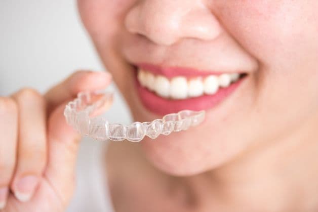 Ưu điểm khi niềng răng Invisalign