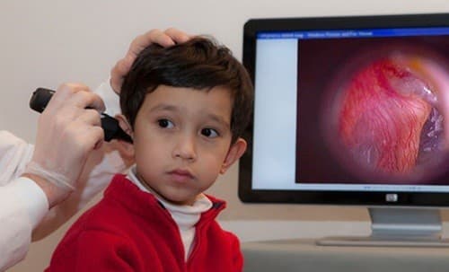 chua-viem-tai-giua-tiet-dich