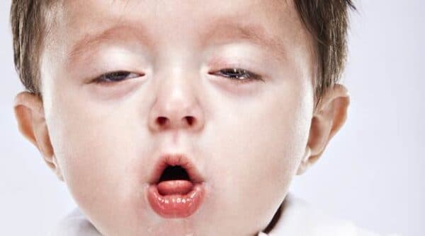 cách điều trị bệnh ho ở trẻ em