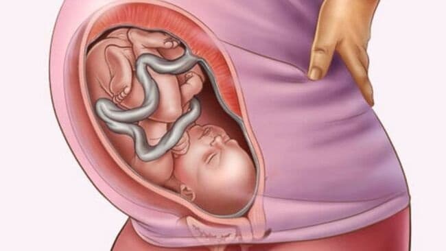 Thai nhi 38 tuần tuổi có kích thước bằng cỡ một quả dưa hấu nhỏ, đầu bé đã lọt xuống hố chậu của mẹ