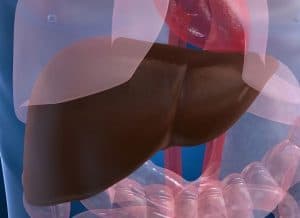 Bệnh gan nhiễm mỡ nếu không được điều trị sẽ đe dọa trực tiếp đến sức khỏe và tính mạng của người bệnh.