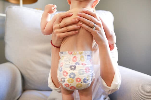 Trẻ dị ứng các thành phần của tã lót có thể bị viêm da tã lót