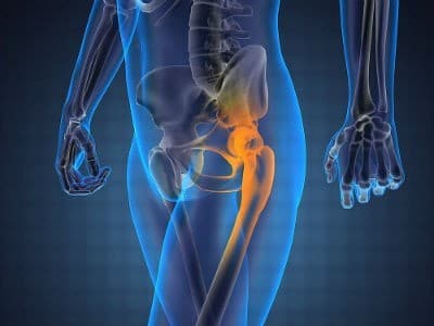 Tìm hiểu về cách điều trị bệnh viêm khớp háng