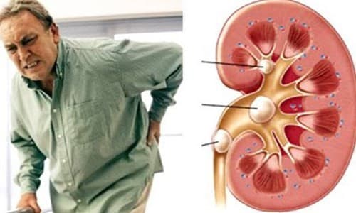 nguyen-nhan-dan-den-suy-than-2