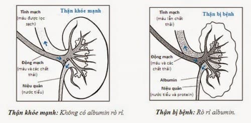 suy-than-giai-doan-1
