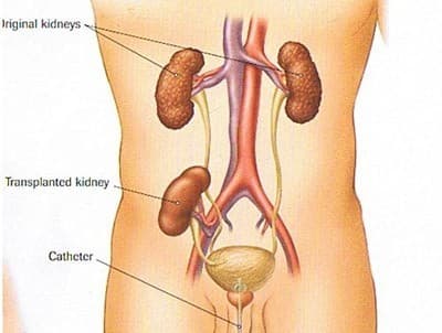Suy thận là bệnh nguy hiểm, đặc biệt với phụ nữ mang thai.