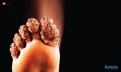 nguoi-bi-benh-gout-nen-uong-sua-gi