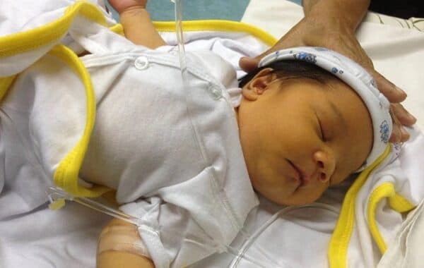 viêm gan ở trẻ em