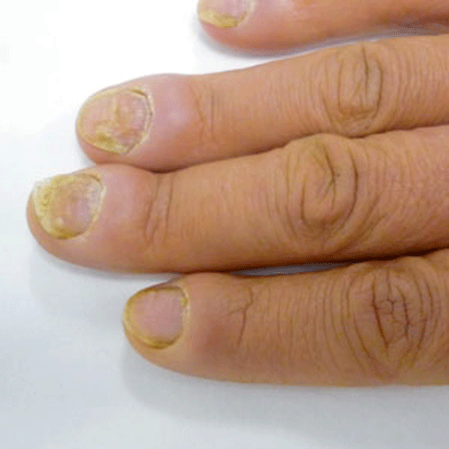 cac-benh-nam-da-thuong-gap2