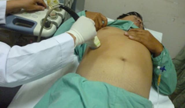 Cách chữa bệnh xơ gan cổ trướng