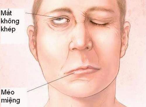 dot-quy-benh-ai-cung-co-the-mac.jpg3