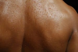 Viêm tuyến mồ hôi khiến người bệnh thường bị ngứa nhiều, nhất là khi trời nóng, lúc ra mồ hôi.