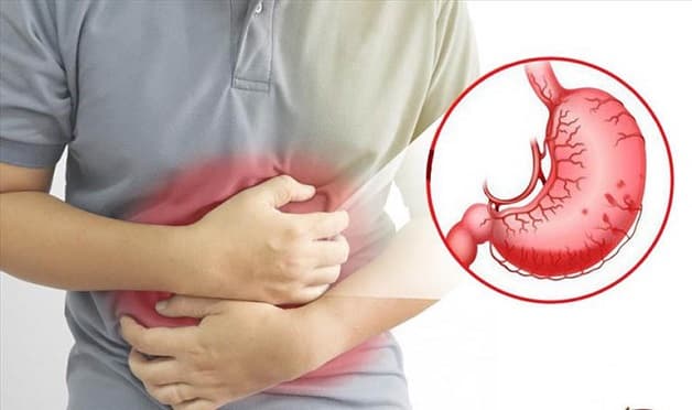 điều trị viêm xung huyết hang vị dạ dày theo chỉ định