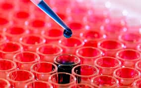 xet-nghiem-ung-thu-som