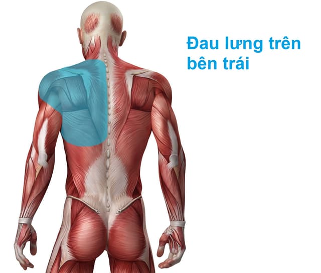 Đau lưng cơ năng là gì? nguyên nhân và cách điều trị