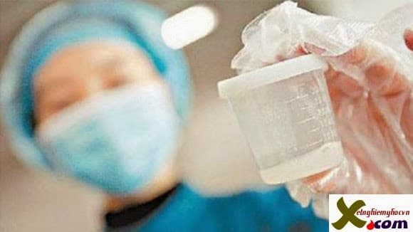 Xét nghiệm tinh trùng như thế nào? Xét nghiệm tinh trùng