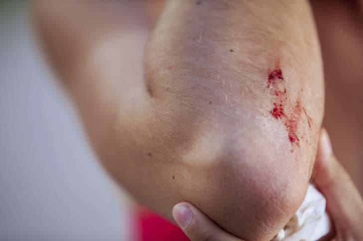 cap-cuu-10715c-74623