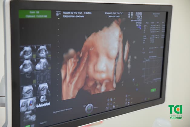 Tuần 32, thai nhi bắt đầu phát triển hơn và cần được theo dõi sát sao hơn