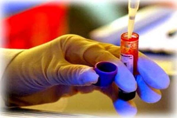 Các xét nghiệm chẩn đoán sớm ung thư