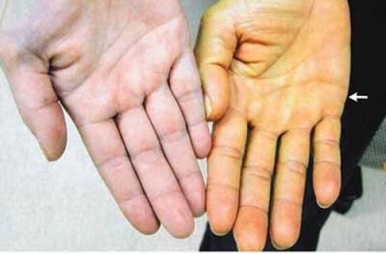 7-dau-hieu-canh-bao-gan-co-van-de.jpg1