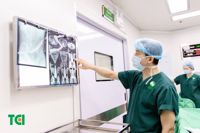 Sỏi thận nên tránh ăn gì để có sức khỏe tốt