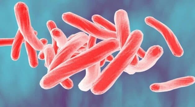 Bệnh lao phát sinh do hoạt động của trực khuẩn Mycobacterium tuberculosis