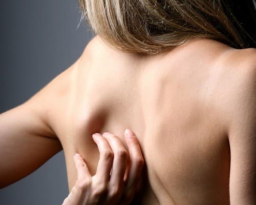 Bệnh nấm da là một trong những bệnh nhiễm nấm ở vùng thượng bì da.