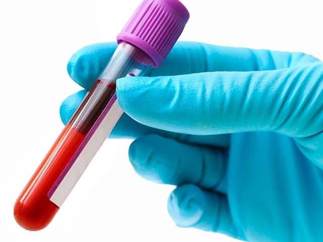 Phát hiện sớm ung thư gan bằng cách nào?