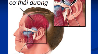 Phòng tránh rối loạn thái dương hàm