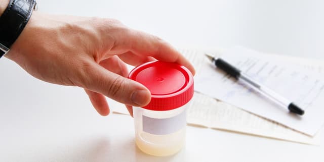 Xét nghiệm tinh dịch đồ vô sinh, hiếm muộn