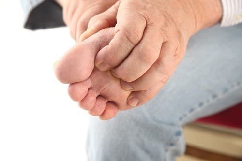 Biểu hiện của bệnh chàm tổ đỉa là có những mụn nước nhỏ ăn sâu dưới lớp thượng bì làm da nổi gồ lên, hình tròn, rải rác hoặc thành chùm, thường xuất hiện ở lòng bàn tay, bàn chân và các rìa ngón tay, ngón chân.