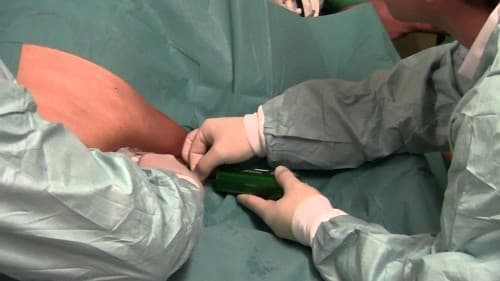 Trong sinh thiết gan, một mẫu nhỏ tế bào gan sẽ được lấy ra để kiểm tra dưới kính hiển vi để tìm kiếm các bất thường nếu có.