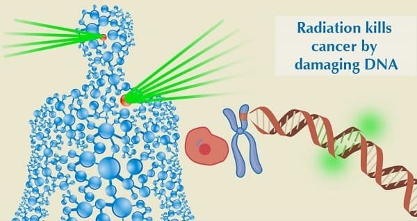 dieu-tri-benh-ung-thu-dau-co (2)