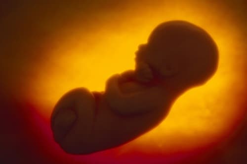 Tràn dịch màng phổi thai nhi là tình trạng chất dịch tích tụ trong các lớp mô bao quanh phổi của bé (khoang màng phổi).