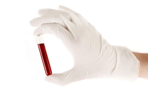 xet-nghiem-beta-hcg-bao-nhieu-tien