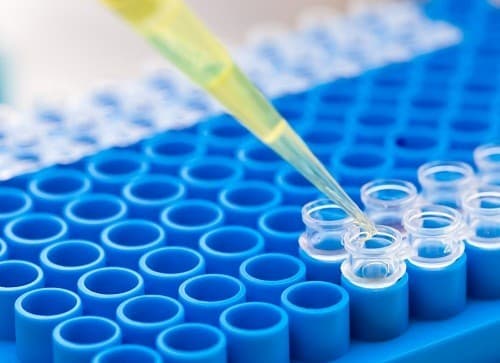 Người ta phát hiện trong huyết thanh những bệnh nhân lupus ban đỏ có khả năng phản ứng với sợi DNA. 