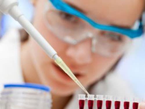 Xét nghiệm nội tiết điều trị vô sinh hiếm muộn
