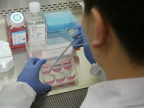 Xét nghiệm nuôi cấy virus có thể xác định nguyên nhân của những biến chứng nghiêm trọng có liên quan tới bệnh quai bị.