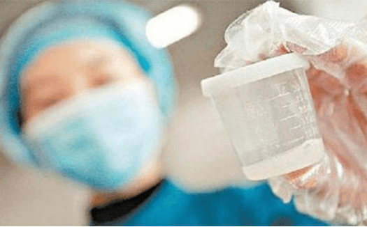 xet-nghiem-tinh-dich-do.1jpg